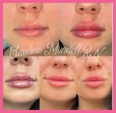 Modern Skin Solutions CT, 495 Gold Star Hwy, Ste 200, Groton, CT 06340, US 