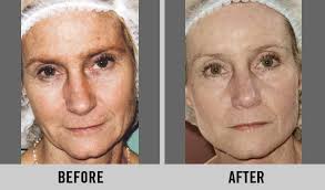 We maintain an unrivaled commitment to the education of aesthetic professional, providing educational criteria to guide and support the skin care professional. Customized Facials Peels Beauty By Design