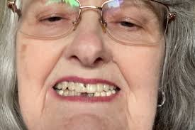 Fundraiser by Brenda Dearborn : Emergency dental surgery and reconstruction  needed