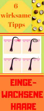 die besten tipps gegen eingewachsene haare ingrown hair tips good things