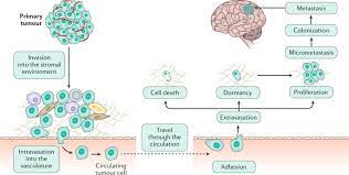 Brain Metastases Nature Reviews Disease Primers