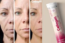 Multi Collagen Antioxidants Nedir Ne Ise Yarar Cildi Genclestirir Mi Yorumlar Kullanim Ve Fiyat