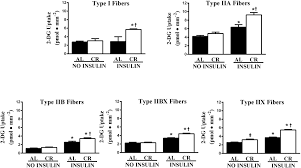 Effects Of Insulin And Diet On Glucose Uptake In Different Fiber Types Download Scientific Diagram