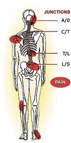 Short Leg Syndrome Part 1 Short Legs Scoliosis Exercises Scoliosis