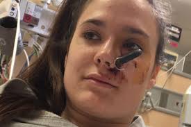 Driver, 24, almost blinded as car key lodges millimetres from her eye when  pal tosses it to her in freak accident