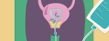 Is Bcg The Same As Chemotherapy Bladdercancer Net
