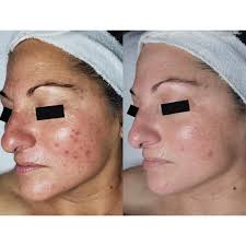 Juniper Moon Aesthetics In Verona WI