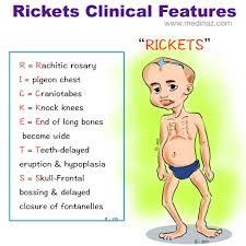 Image result for Craniotabes