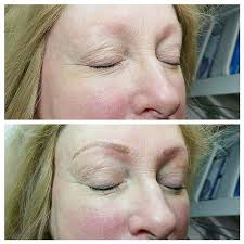 And after that, i will be sure to add a picture of them healed. Microblading And Redhead Eyebrows Everything You Need To Know