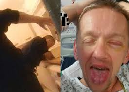 Police officer who was partially blinded in ammonia attack speaks out