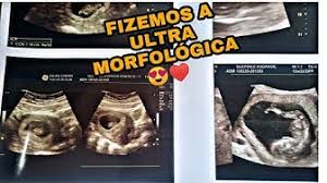 Ultrassommorfologica Youtube