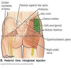 Dg R Uoq Im Nursing School Notes Medical Knowledge Nursing Notes
