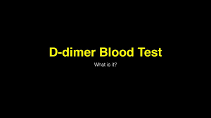 Normal or slightly elevated samples will yield negative results in both dilutions. D Dimer Blood Test Youtube