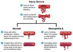 Hemophilia, or haemophilia, is the name of any of several hereditary genetic illnesses that impair the body's ability to control bleeding. Hemophilia