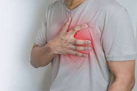 Image result for Chest Pain