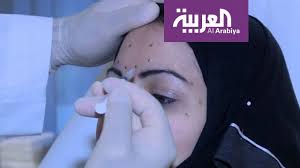 صباح العربية إذا حقن الفيلر في هذا المكان قد يسبب العمى Youtube