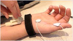 Elektromyographie Und Elektroneurographie Praxis Fur Neurologie Und Psychologie Felix Fischer Dr Med Ulf Karwelies Und Dr Med Heike Eckardt In Verl