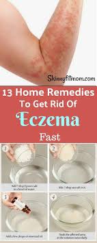 We look at the symptoms, causes and how to get rid of it. 13 Home Remedies To Get Rid Of Eczema Fast That Really Work Get A Smooth Skin A Get Rid Of Eczema Holistic Healing Natural Treatments Home Remedies For Eczema