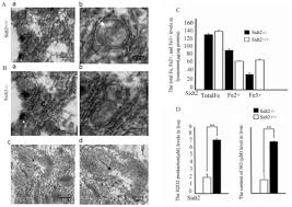 We did not find results for: Changes Of Lysosomal Membrane Permeabilization And Lipid Metabolism In Sidt2 Deficient Mice