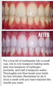 Whiten Your Teeth Health And Beauty Beauty Hacks Diy Beauty