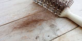 We did not find results for: 12 Kondisi Yang Menyebabkan Rambut Rontok Halaman All Kompas Com