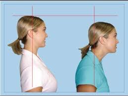 Pin On Fitness Bad Posture Forward Neck Head Fixes 2016 Sort Later
