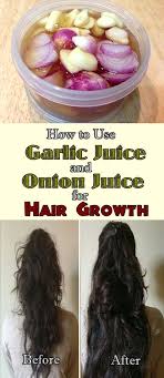 How To Use Garlic And Onion Juice For Hair Growth Oliveoil Shampoo Naturalcure Onion Juice For Hair Garlic For Hair Growth Onion Juice Hair Growth
