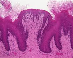 Image result for Filiform Papillae