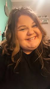 noticing that i'm losing weight in my face!! first pic is 2 years ago,  second pic is today! i'm 5 weeks post-op