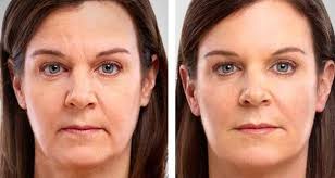 La Creme Antirides Faite Maison Qui Donne Des Resultats Rapidement Sante Beaute Coiffure Et Beaute Conseils Soins De La Peau