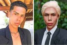 Ex-Ken humano vira frentista após abandonar transformação