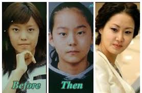 Salut Deh Tiga Artis Korea Ini Jujur Melakukan Operasi Plastik Matamata Com