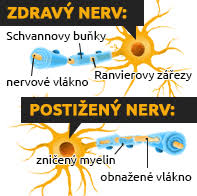 Check spelling or type a new query. Roztrousena Skleroza Mentem Cz