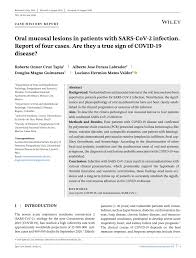Our urgent care in san marcos treats illnesses and injuries that require immediate, but not emergency care. Pdf Oral Mucosal Lesions In Patients With Sars Cov 2 Infection Report Of Four Cases Are They A True Sign Of Covid 19 Disease