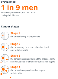 Please understand that our pho. Prostate Cancer Stages Cancerwalls
