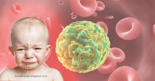 Sakit kepala yang berlaku secara berterusan boleh menjadi salah satu gejala awal tumor otak. Apa Itu Kanser Darah Kenali Kanser