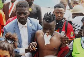 Bobi wine became famous as a pop star, before moving into politics. Several Injured As Bobi Wine Supporters Clash With Uganda Police Citizentv Co Ke