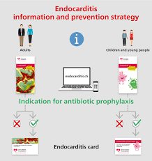 Image result for SBE Prophylaxis