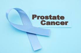 Advanced prostate cancers may cause many. Prostate Cancer Symptoms 5 Early Signs Of Prostate Cancer You Should Know Health Thoroughfare