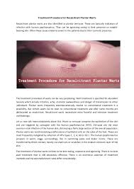 Common warts (verruca vulgaris) are benign epithelial proliferations associated with human topical vitamin a has been shown to be a successful treatment of common warts in prior informal studies. Treatment Procedure For Recalcitrant Plantar Warts