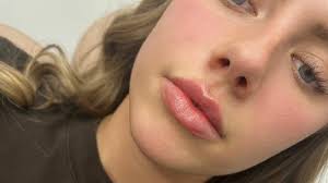 Best Medspas near me in Brisbane