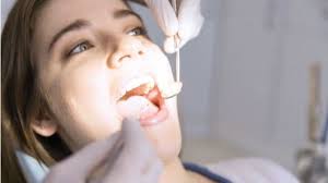 Encias Blancas Causas Sintomas Y Tratamiento Face Clinic