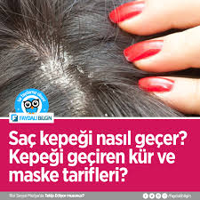Sac Kepegi Nasil Gecer Kepegi Geciren Kur Ve Maske Tarifleri Sac Sac Bakimi Maskeler