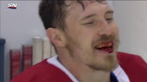 However, he has been cleared to return to the ice. Stanley Cup Playoffs 2020 Canadiens Brendan Gallagher Suffers Broken Jaw Flyers Matt Niskanen Suspended Cbssports Com