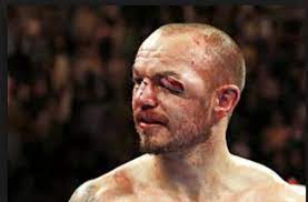 I sleep in my boxer shorts everyday. The Rulings Pertinent To Boxing Professional Cage Fighting The Deen Show