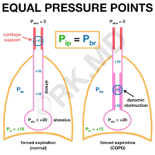 Image result for Intrapleural Anesthesia