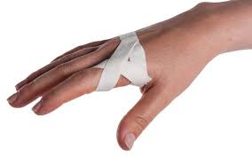 Sprained Knuckle Taping Kinesio Taping Sprain Arthritis In Fingers
