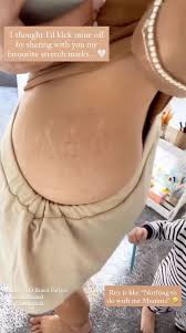 To be at full stretch +person (physically) estirarse al máximo; Stacey Solomon Shows Off Stretch Marks And Says She Loves To Watch Them Sparkle In The Sun Irish Mirror Online