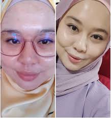 EADA DERMASTHETICS HQ‎‏ (@‏‎eada_dermastheticshq‎‏) · ‏‎Semenyih‎‏