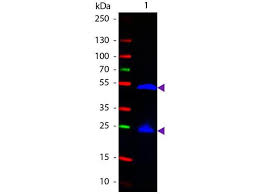 View our alternatives for ab245991 or you can download the archived datasheet pdf from this page. Anti Rat Secondary Antibodies Www Antibodies Online Com
